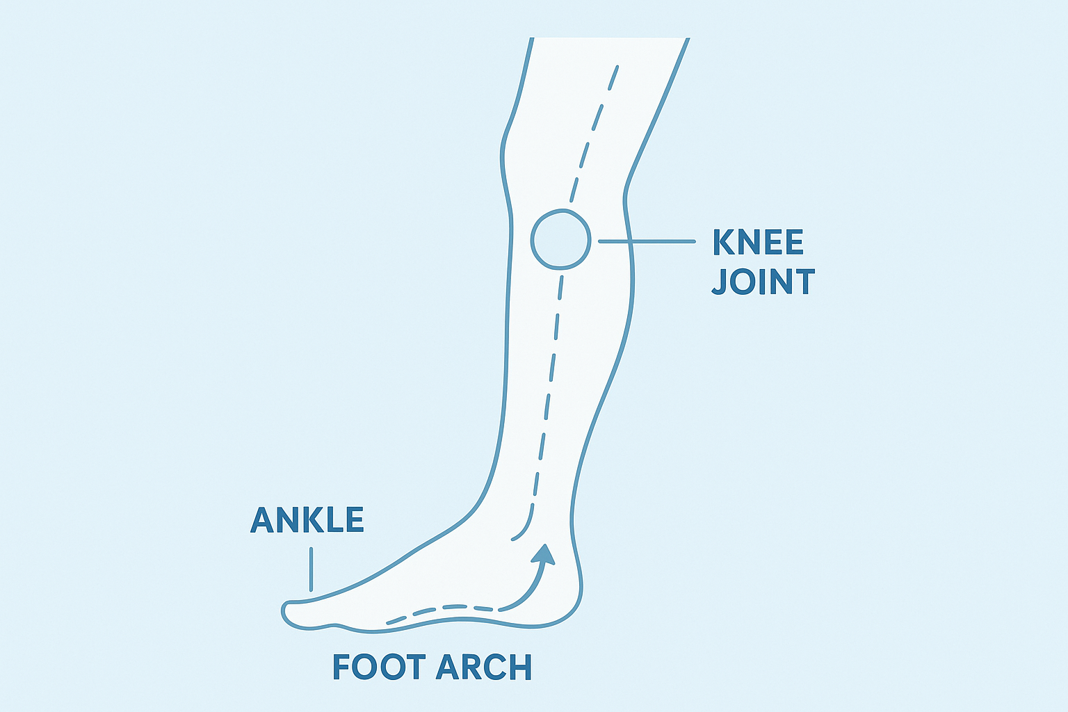 Diagram showing how foot alignment affects knee joint pressure