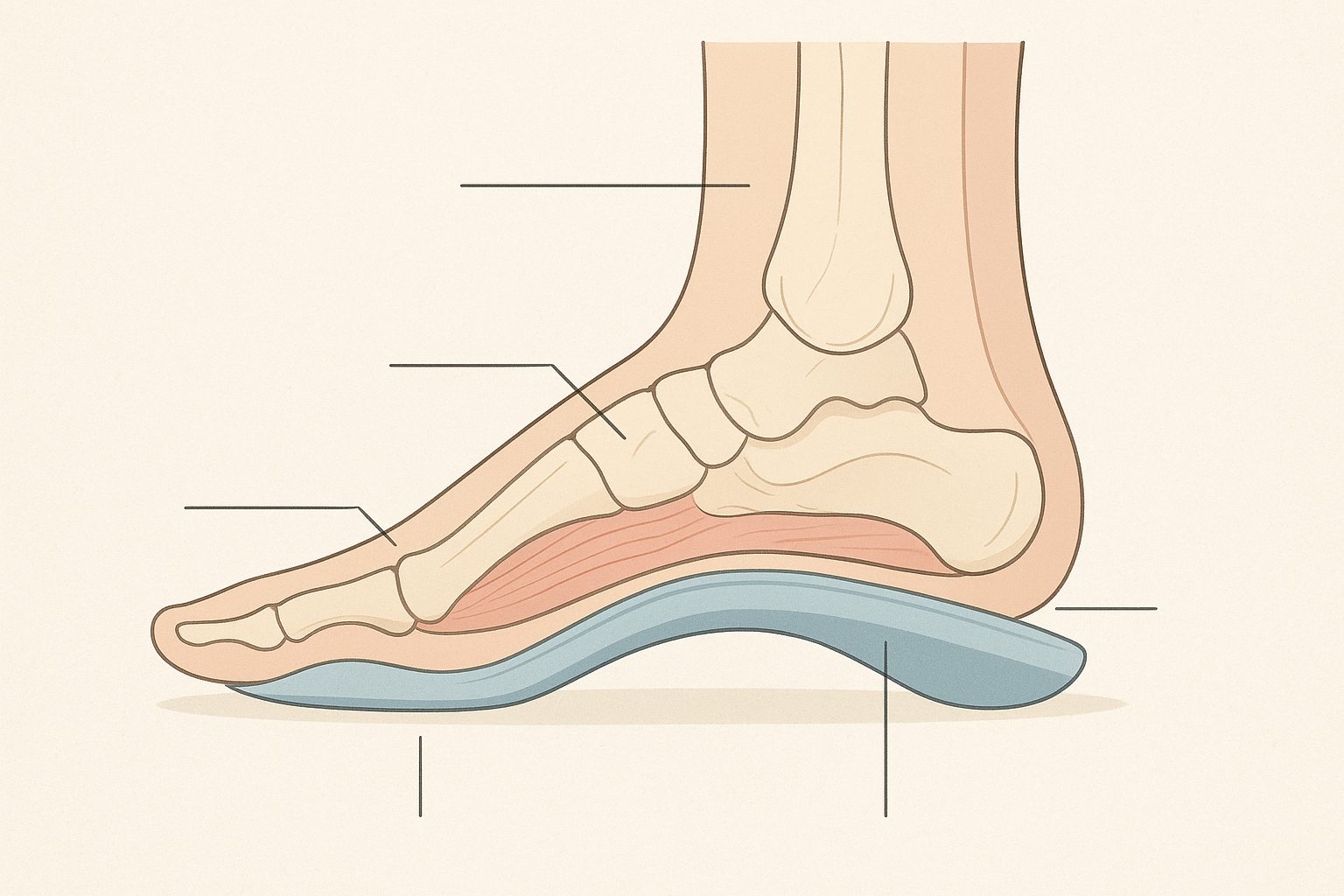 Diagram showing how a walking orthotic supports the foot arch during movement